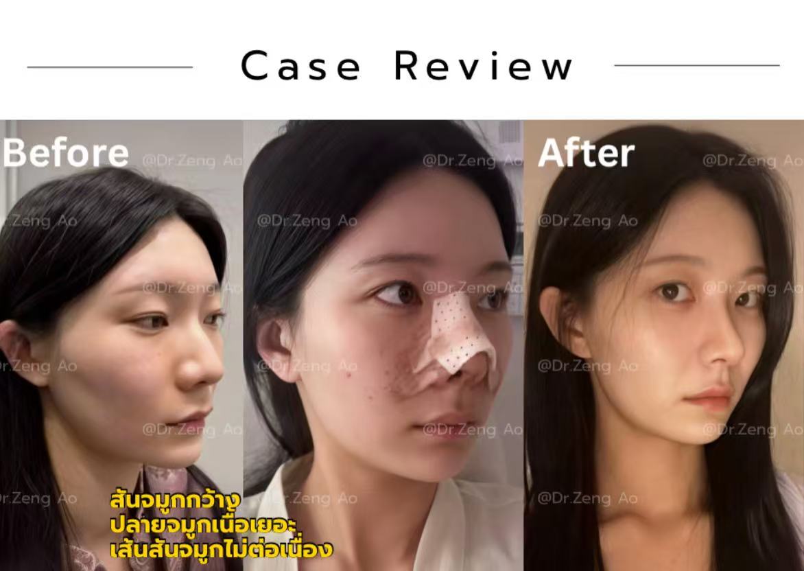 8df32fb7e005557c44fd46c70a936a34