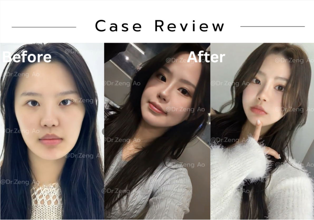 cd280a2794faa0d431141b1eae64aa49