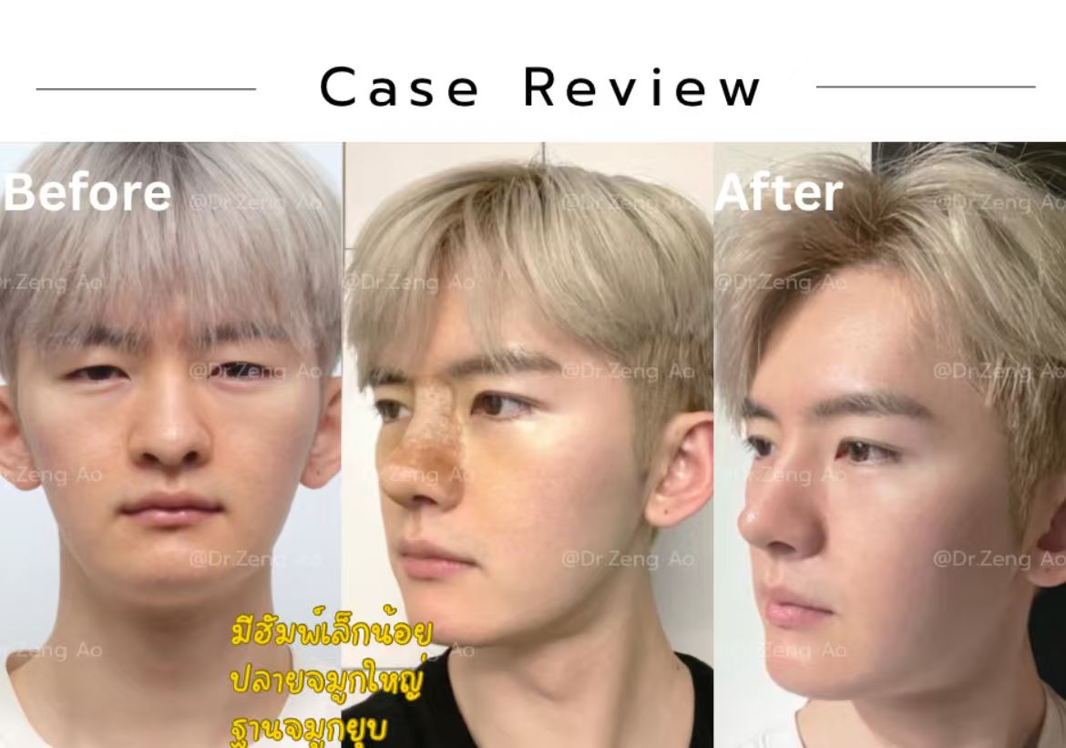 f49705cefe770b72ec0f458c83f3256e